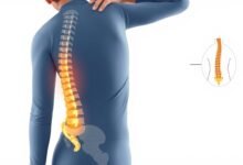Ilustrasi latihan nyeri punggung bawah skoliosis ringan dengan postur yang benar
